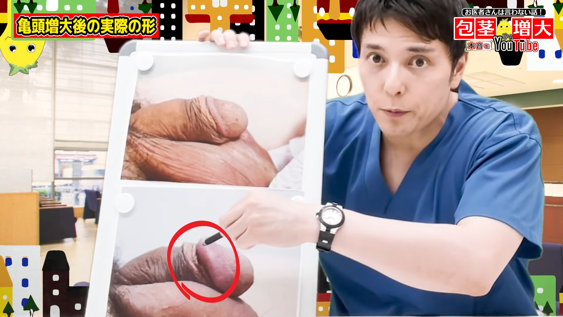 亀頭増大でペニスが凸凹しない？治療前後の写真大公開！ | MENS FAIR（ネオ形成のフェアクリニック）