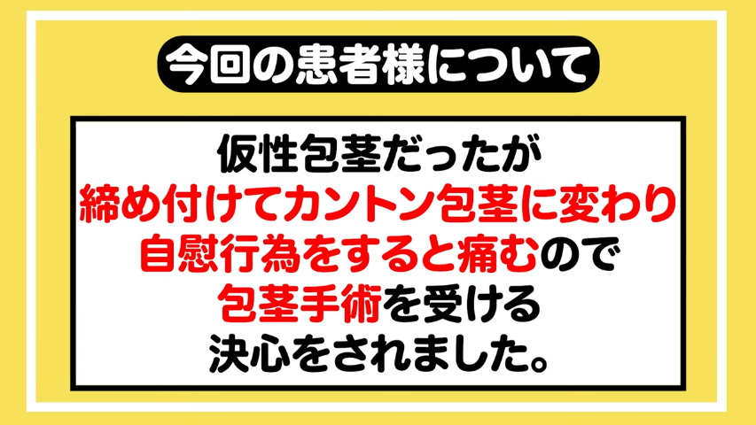 包茎手術から２週間経過、射精を我慢するのがツライ！